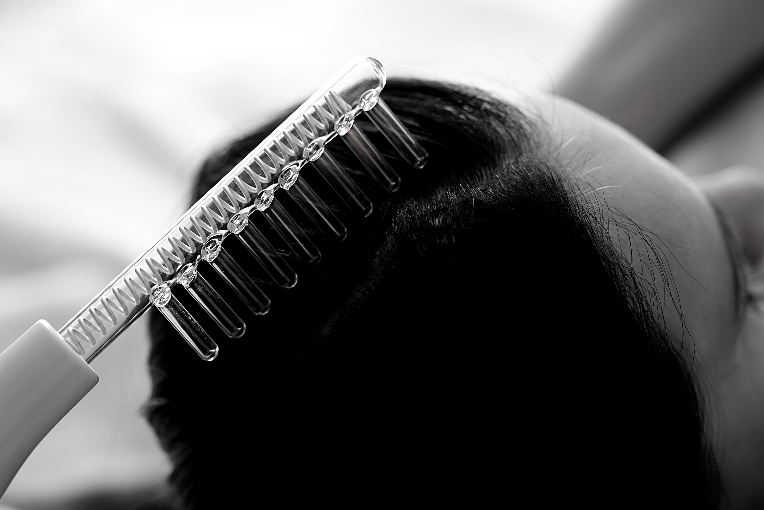 On Female Hair There Is Device for Restoration of Hair Follicles